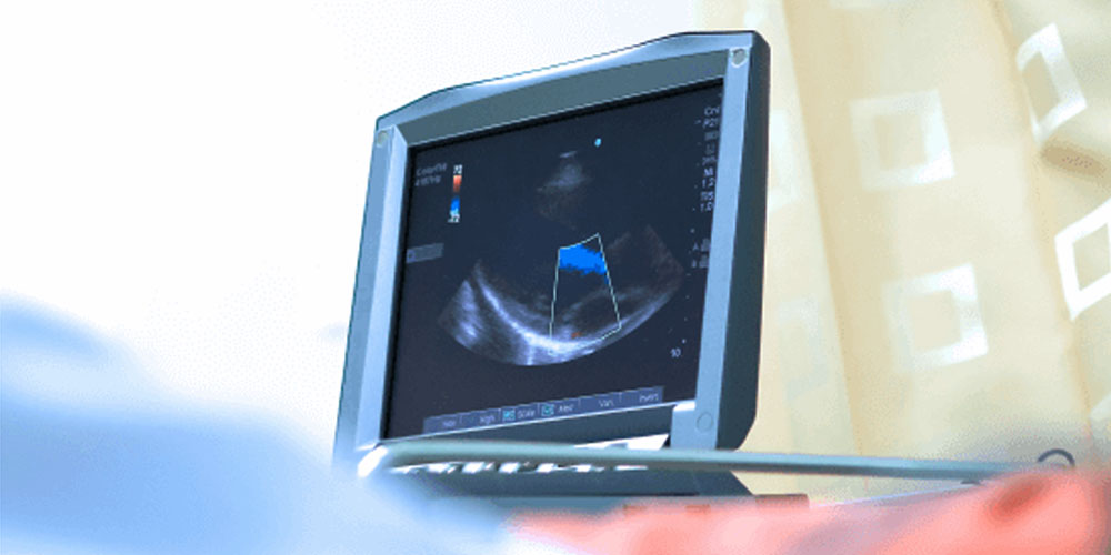 echocardiography