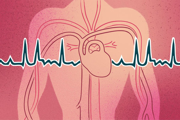 preventive-cardiology